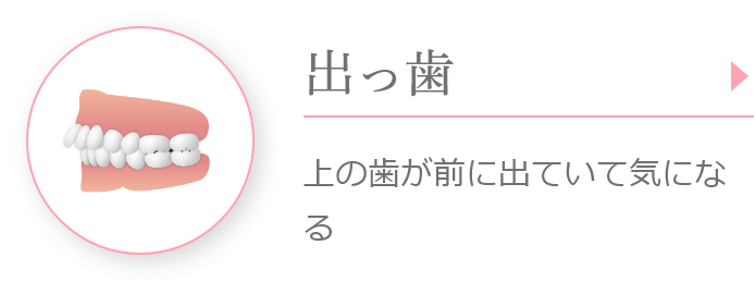 出っ歯