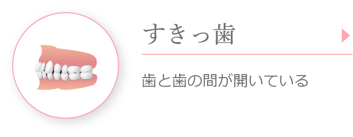 すきっ歯